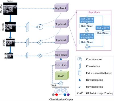 A Multi-Scale Densely Connected Convolutional Neural Network for Automated Thyroid Nodule Classification